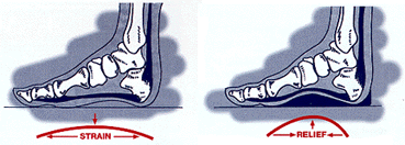 pain-plantar.png